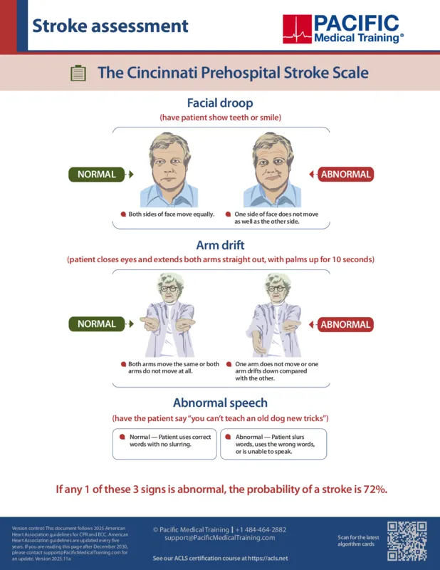 Suspected stroke ACLS algorithm