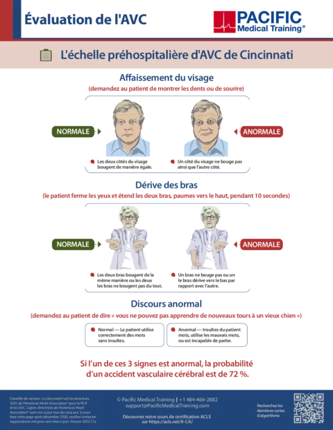 Algorithme d'AVC suspecté