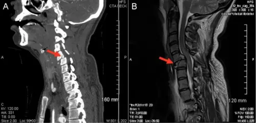 Cardiac CT scan