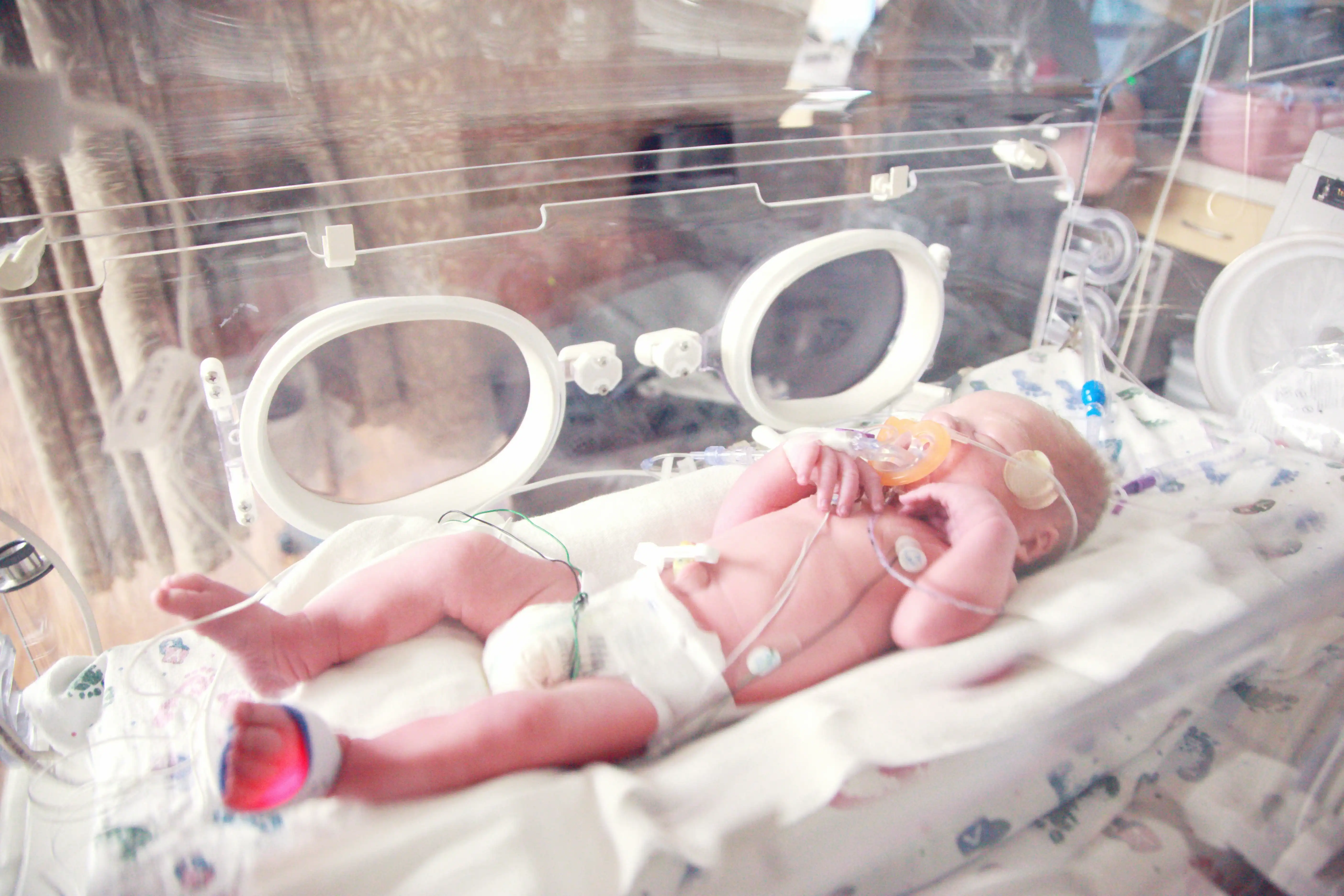 Baby in incubator